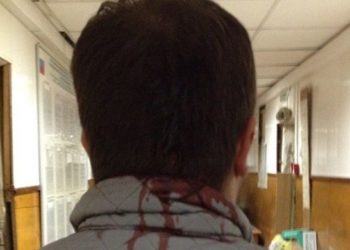 Новосибирского журналиста избили за замечание на счет парковки