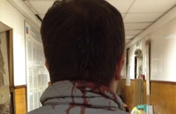 Новосибирского журналиста избили за замечание на счет парковки