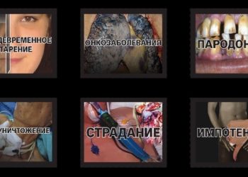 Бегуны «Ампутация», «Импотенция», «Парадонтоз» будут состязаться в знак отказа от курения