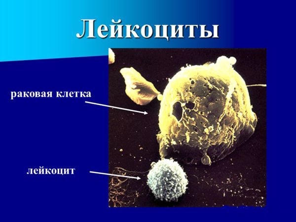 Новосибирские ученые нашли новый способ борьбы с раком