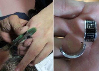 Спасатели полчаса распиливали болгаркой кольцо на пальце жительницы Новосибирска