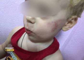 Новосибирские следователи проверяют, избивали ли ребенка в детском саду