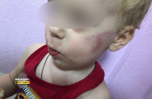 Новосибирские следователи проверяют, избивали ли ребенка в детском саду