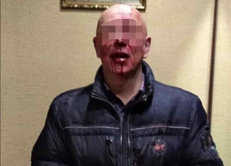 Подростки толпой выбили зубы и сломали челюсть новосибирцу на МЖК