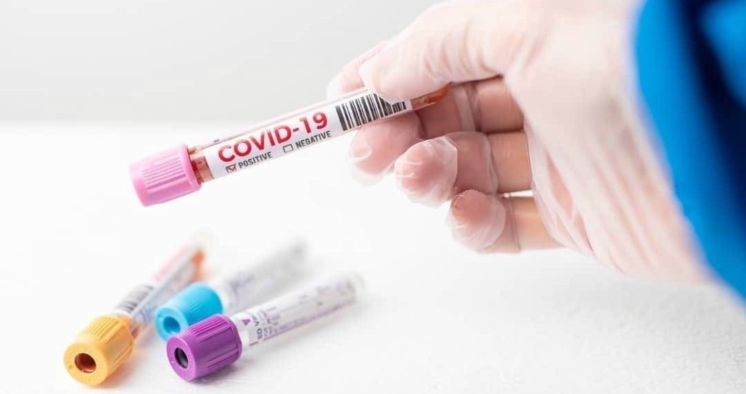 Доминирующие штаммы коронавируса сменятся в течение нескольких месяцев в России