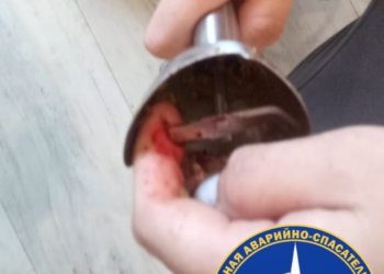 Палец из блендера помогли вызволить спасатели жительнице Новосибирска