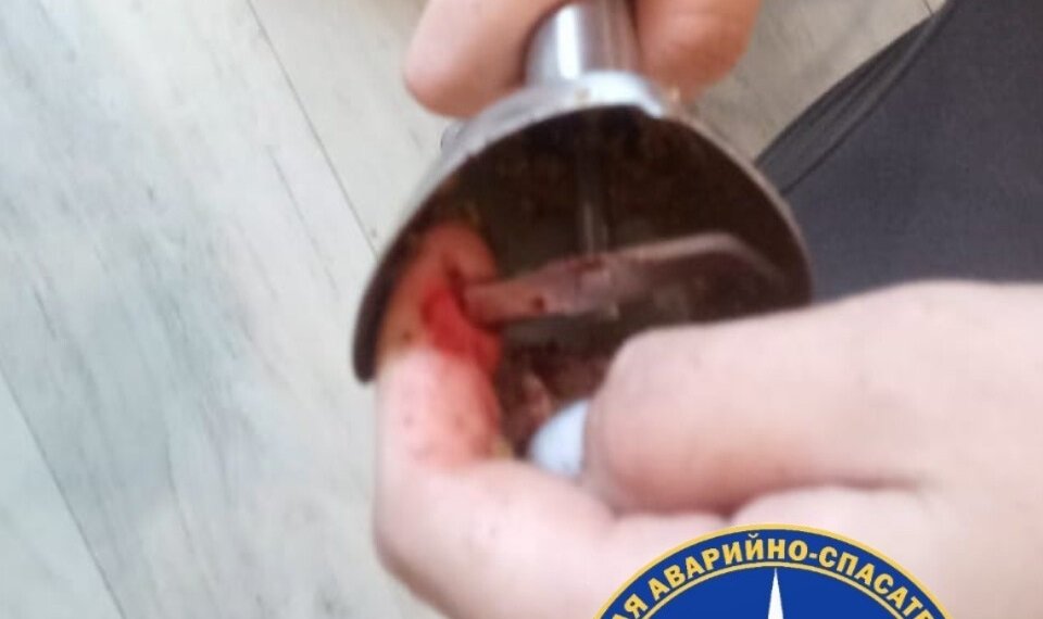 Палец из блендера помогли вызволить спасатели жительнице Новосибирска