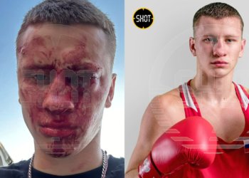 Чемпион России по боксу Дмитрий Двали заступился за ребенка и лишился глаза