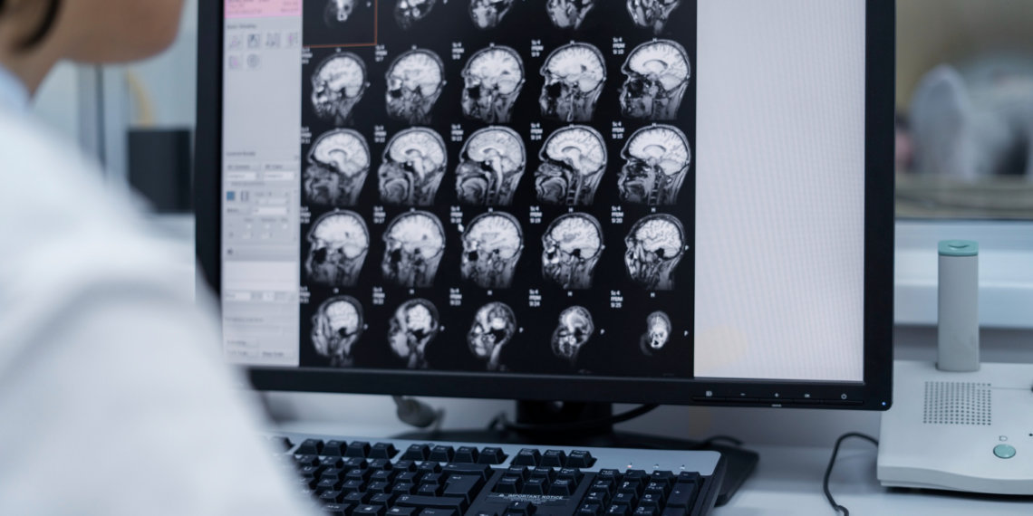 Приложение для выявления опухолей головного мозга разработали российские учёные