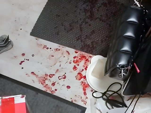 Мужчина напал с ножом на бывшего сожительницы за поздний визит