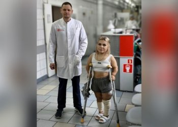 Новосибирские хирурги помогли пациентке с разной длиной ног с помощью эндопротеза